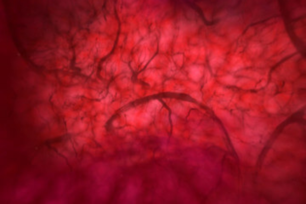 Still from the 2D film FASD – The Unborn Child’s View